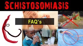 Why amp what is schistosomiasis   FAQ [upl. by Nagey133]