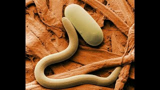 What are nematodes [upl. by Semyaj]