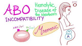 ABO incompatibility mnemonic  Hemolytic Anemia  Normocytic Anemia [upl. by Aissatsana793]