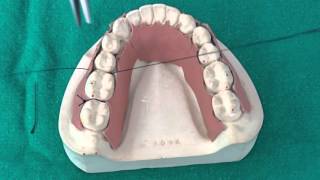 Peridontal Suturing Techniques [upl. by Derr]