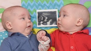 WHY I THOUGHT I WAS HAVING TWINS BEFORE MY FIRST ULTRASOUND  TWIN MOM  TWIN PREGNANCY SIGNS [upl. by Llednol]