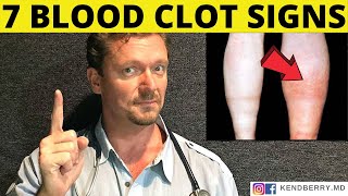 7 Warning Signs of a BLOOD CLOT Symptoms 2024 [upl. by Nichol80]