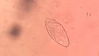 Schistosoma haematobium egg [upl. by Arahk]