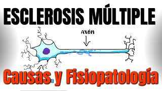 Esclerosis múltiple CAUSAS y FISIOPATOLOGÍA  P1 [upl. by Norby]