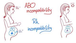 ABO incompatibility vs Rh incompatibility [upl. by Sansbury]