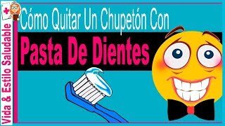 Cómo quitar un chupetón con Pasta De Dientes ✫ TRUCO que NO CONOCES FUNCIONA ❤ [upl. by Harlie]