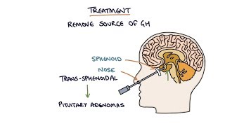 Understanding Acromegaly [upl. by Cirded]