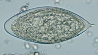 Schistosoma Haematobium [upl. by Patrizius218]