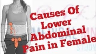 Causes of Lower Abdominal Pain in Female [upl. by Ennahgiel39]