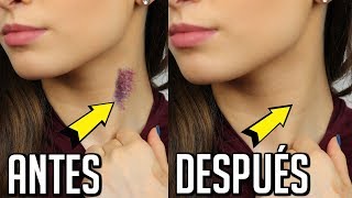 COMO QUITAR UN CHUPETON DEL CUELLO  TRUCOS DE MAQUILLAJE  LAURA MEJIA [upl. by Ferguson]