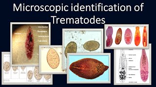 Microscopic identification of Trematodes [upl. by Heidie]