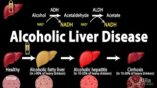 Alcoholic Liver Disease Animation [upl. by Gardel360]