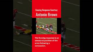 Fencing Response Courtesy Antonio Brown [upl. by Arias86]