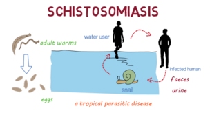 Schistosomiasis Bilharzia– an overview [upl. by Rawley852]