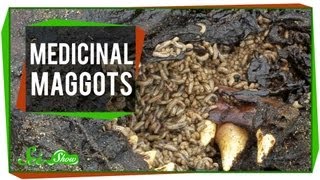 Marvelous Medicinal Maggots [upl. by Ahsenev]