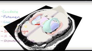 Basal Ganglia 3D Tour [upl. by Onez]