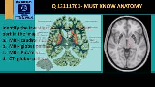 MRI Brain anatomy  Basal ganglia [upl. by Silverstein360]